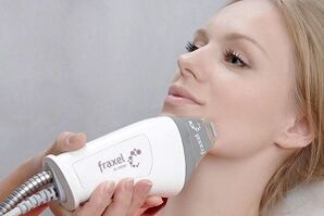 беттин терисин омолоштуруу процедурасынын маңызы